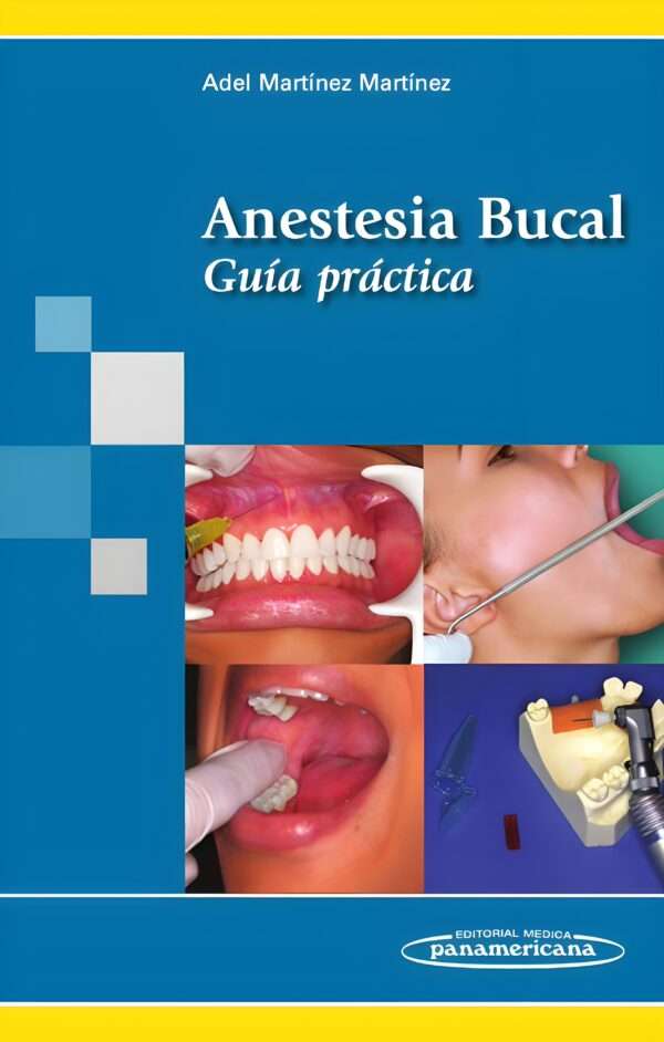 Anestesia Bucal. Guia Practica