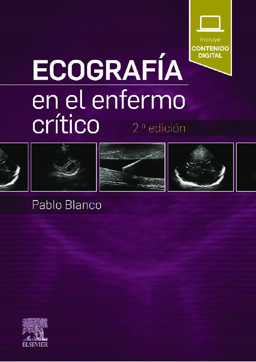 Ecografia en el enfermo critico 2a Edicion