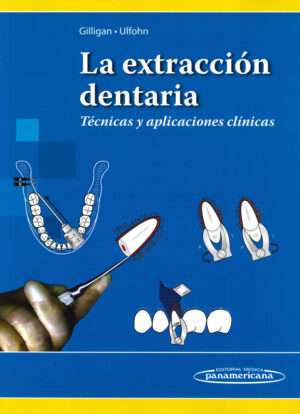 La extraccion dentaria. Tecnicas y aplicaciones clinicas