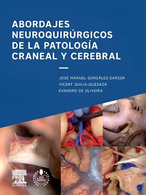 Abordajes neuroquirurgicos de la patologia craneal y cerebral