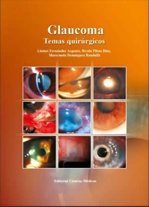 Glaucoma Temas quirurgicos