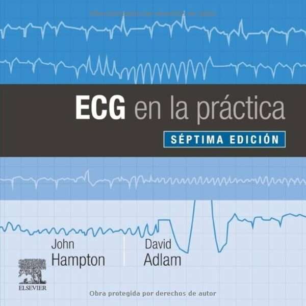 ECG en la Practica 7 Edicion