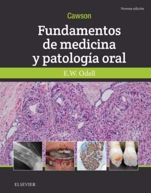 Cawson Fundamentos de medicina y patologia oral