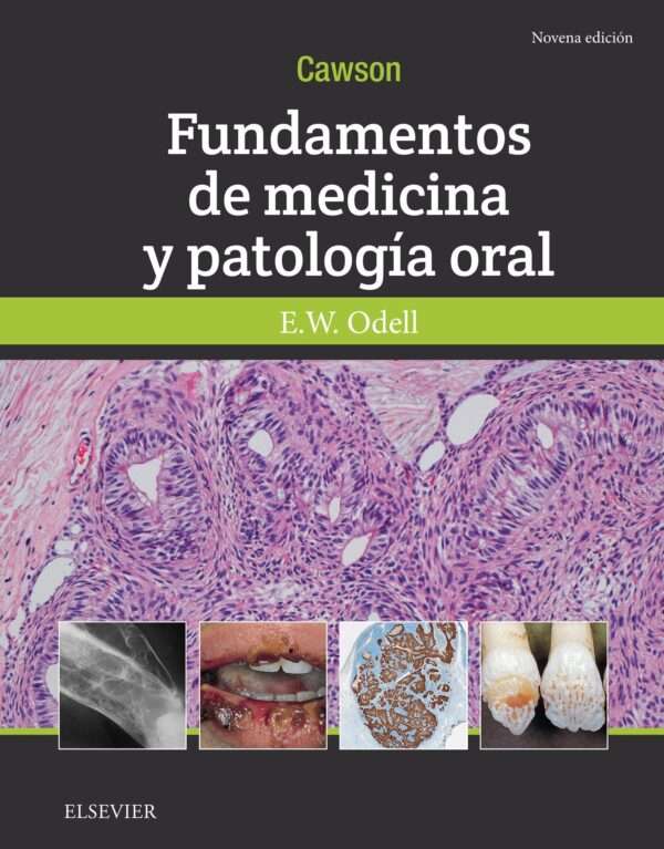 Cawson Fundamentos de medicina y patologia oral