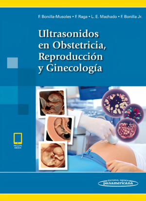 Ultrasonidos en Obstetricia, Reproduccion y Ginecologia